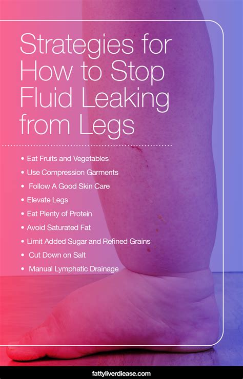 clear fluid leaking from leg|6 tips for managing leaky legs